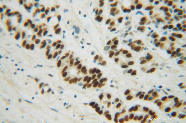 METTL1 Antibody in Immunohistochemistry (Paraffin) (IHC (P))