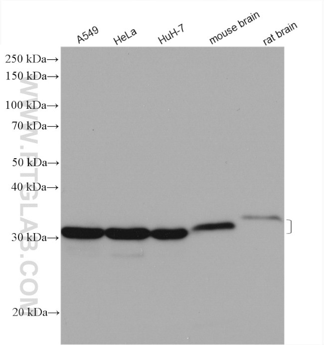 METTL1 Antibody in Western Blot (WB)