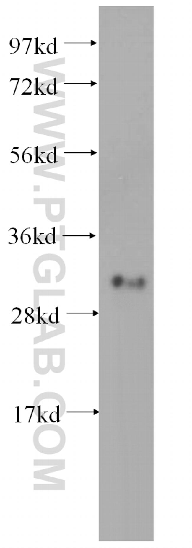 METTL1 Antibody in Western Blot (WB)