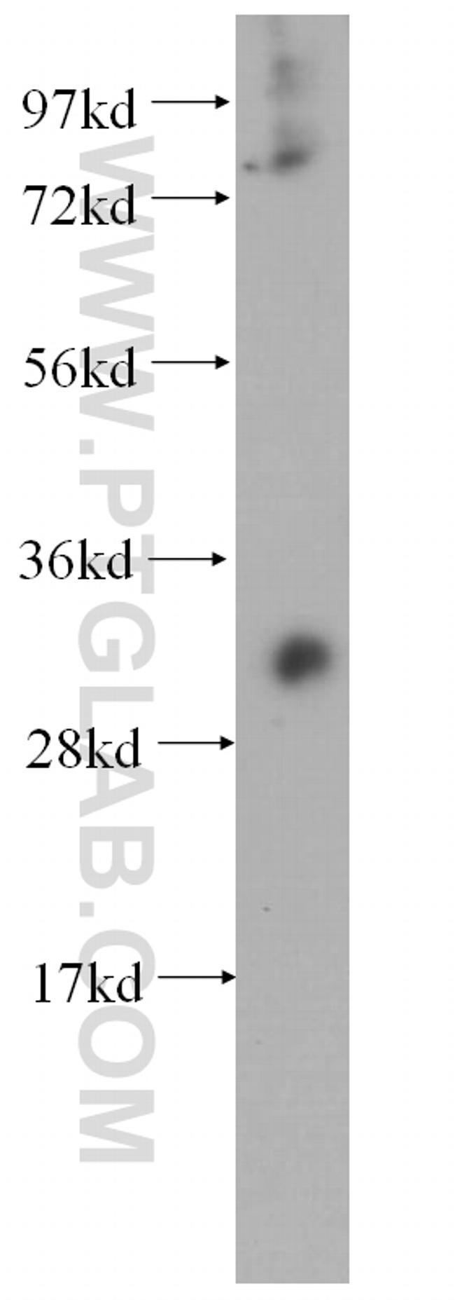 METTL1 Antibody in Western Blot (WB)