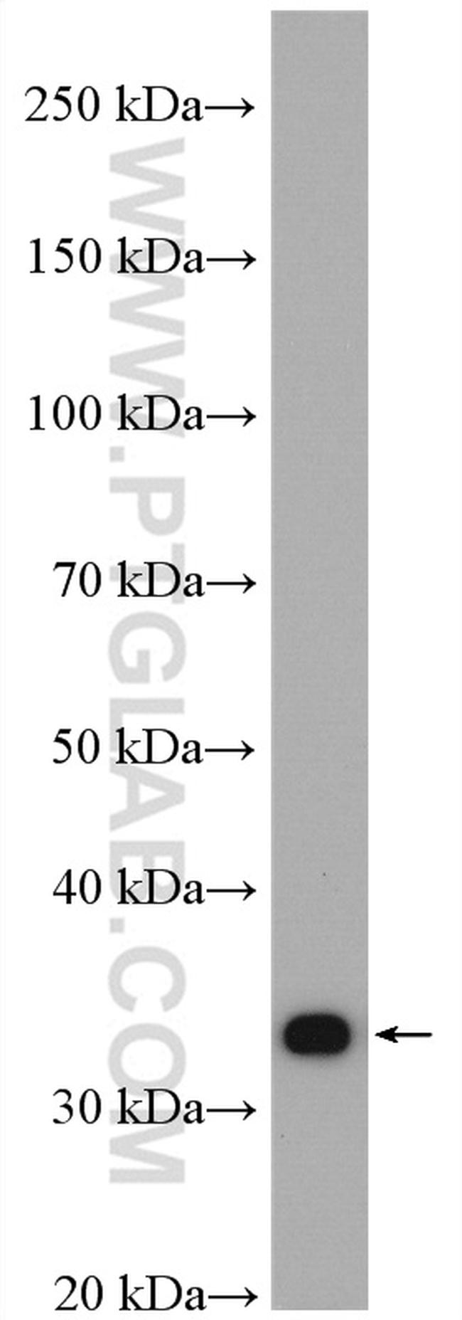 METTL1 Antibody in Western Blot (WB)