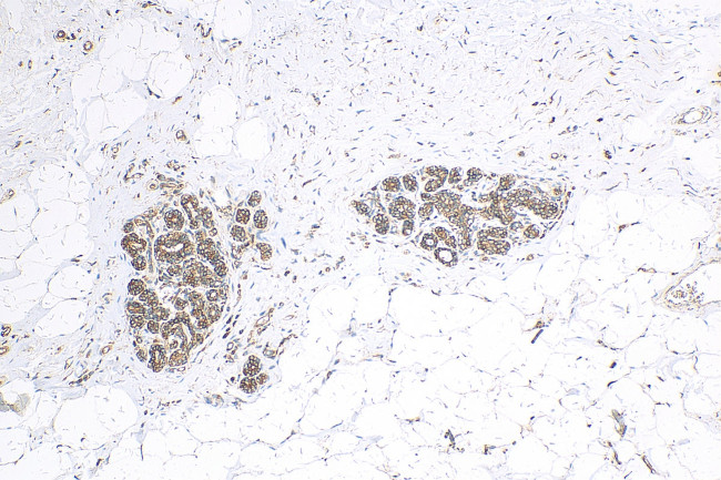 ABCB6 Antibody in Immunohistochemistry (Paraffin) (IHC (P))