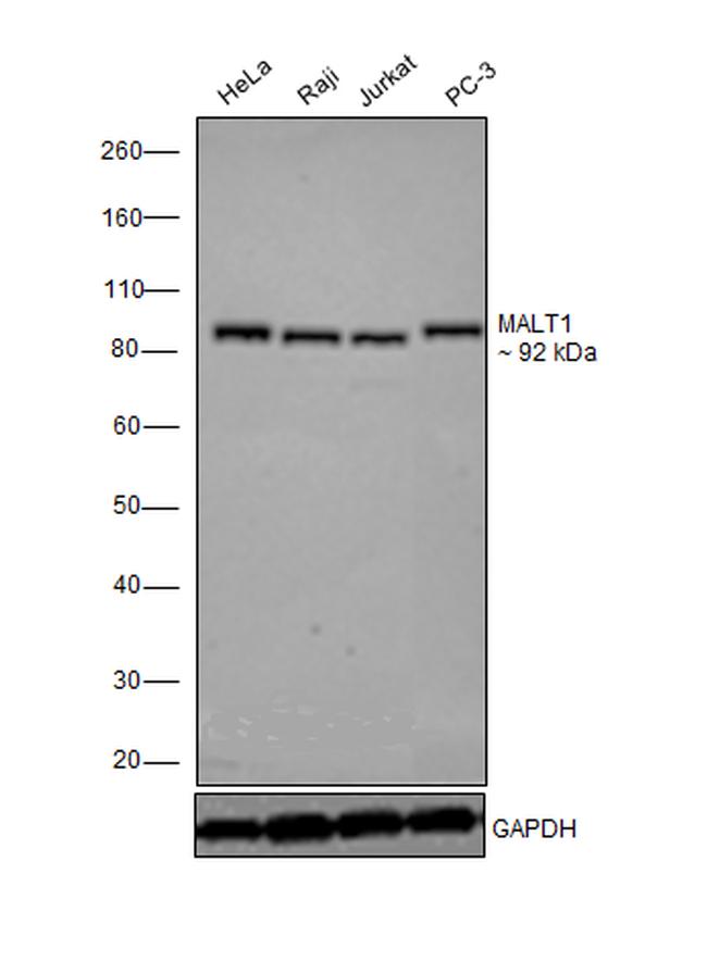 MALT1 Antibody in Western Blot (WB)