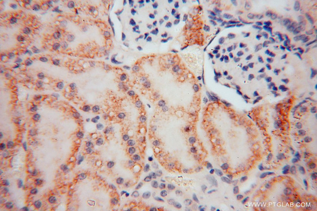 RENALASE Antibody in Immunohistochemistry (Paraffin) (IHC (P))