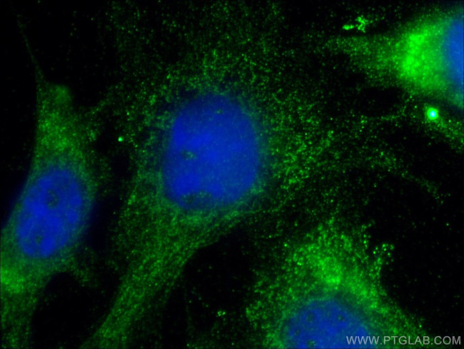 HAI-1 Antibody in Immunocytochemistry (ICC/IF)