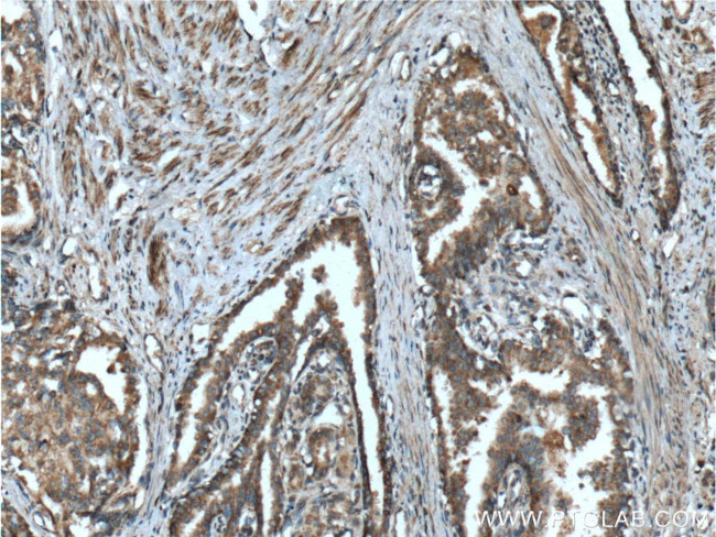 HAI-1 Antibody in Immunohistochemistry (Paraffin) (IHC (P))