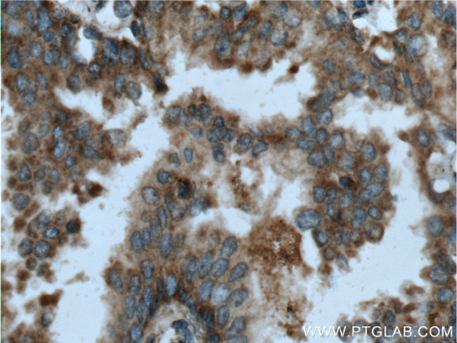 HAI-1 Antibody in Immunohistochemistry (Paraffin) (IHC (P))