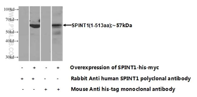 HAI-1 Antibody in Western Blot (WB)