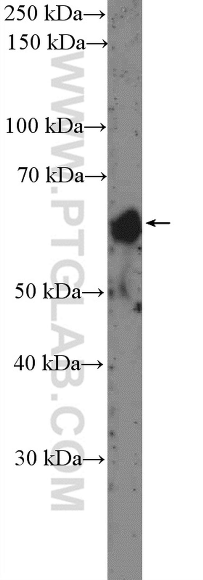 HAI-1 Antibody in Western Blot (WB)