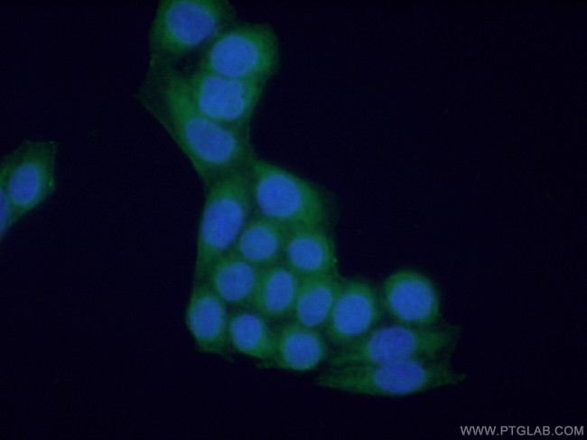 NAGK Antibody in Immunocytochemistry (ICC/IF)