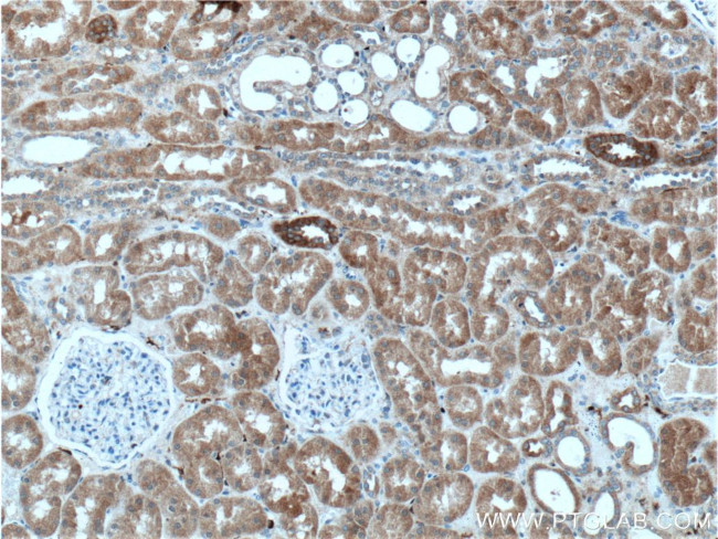 NAGK Antibody in Immunohistochemistry (Paraffin) (IHC (P))