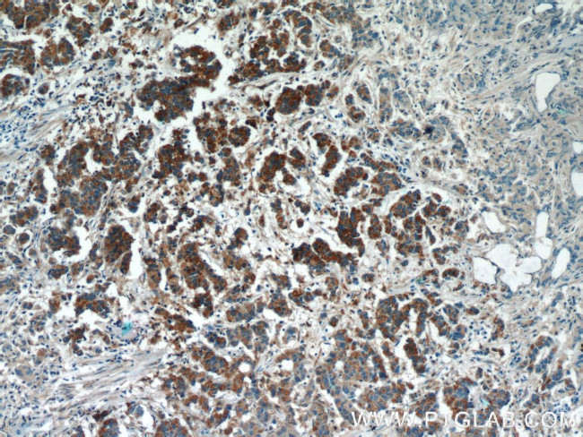 SMOX Antibody in Immunohistochemistry (Paraffin) (IHC (P))