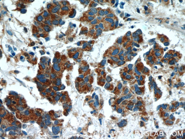 SMOX Antibody in Immunohistochemistry (Paraffin) (IHC (P))