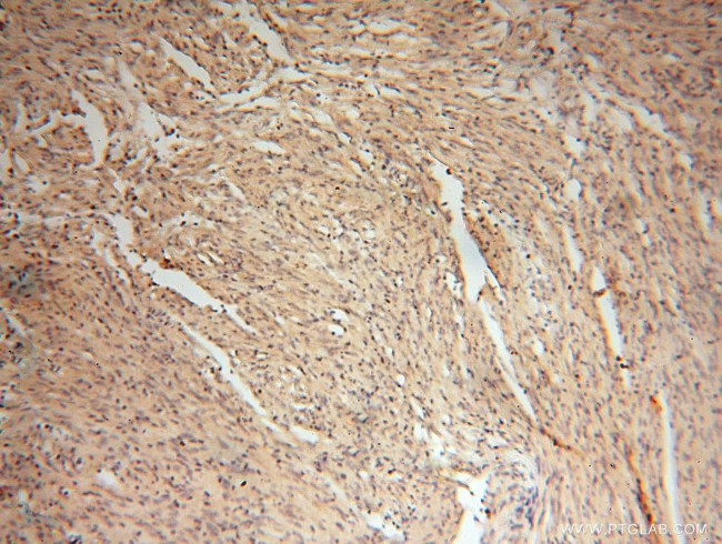 SMOX Antibody in Immunohistochemistry (Paraffin) (IHC (P))