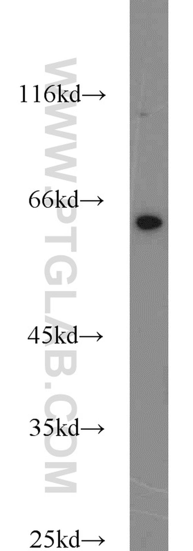 SMOX Antibody in Western Blot (WB)