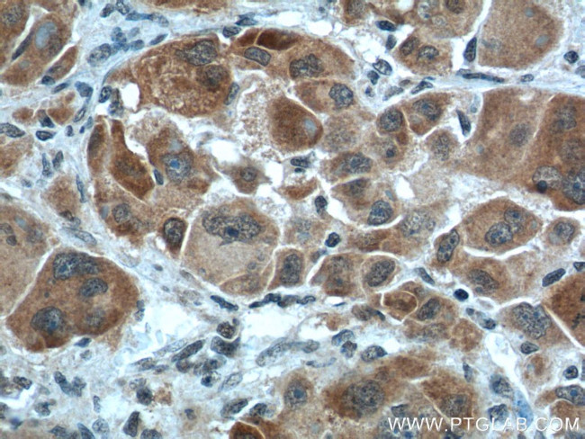 NUPR1 Antibody in Immunohistochemistry (Paraffin) (IHC (P))