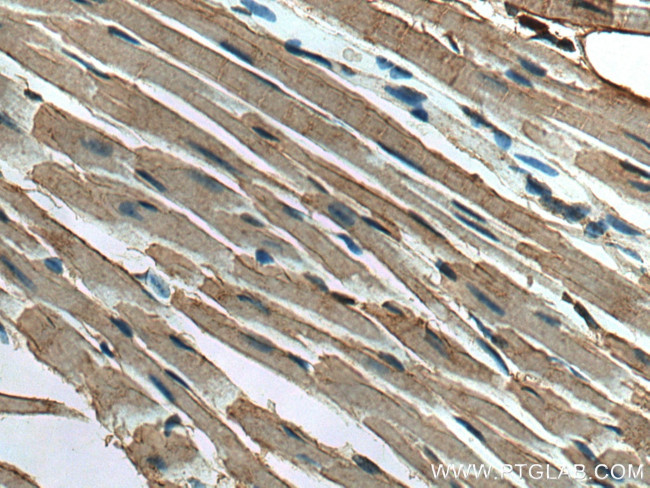 TARS2 Antibody in Immunohistochemistry (Paraffin) (IHC (P))