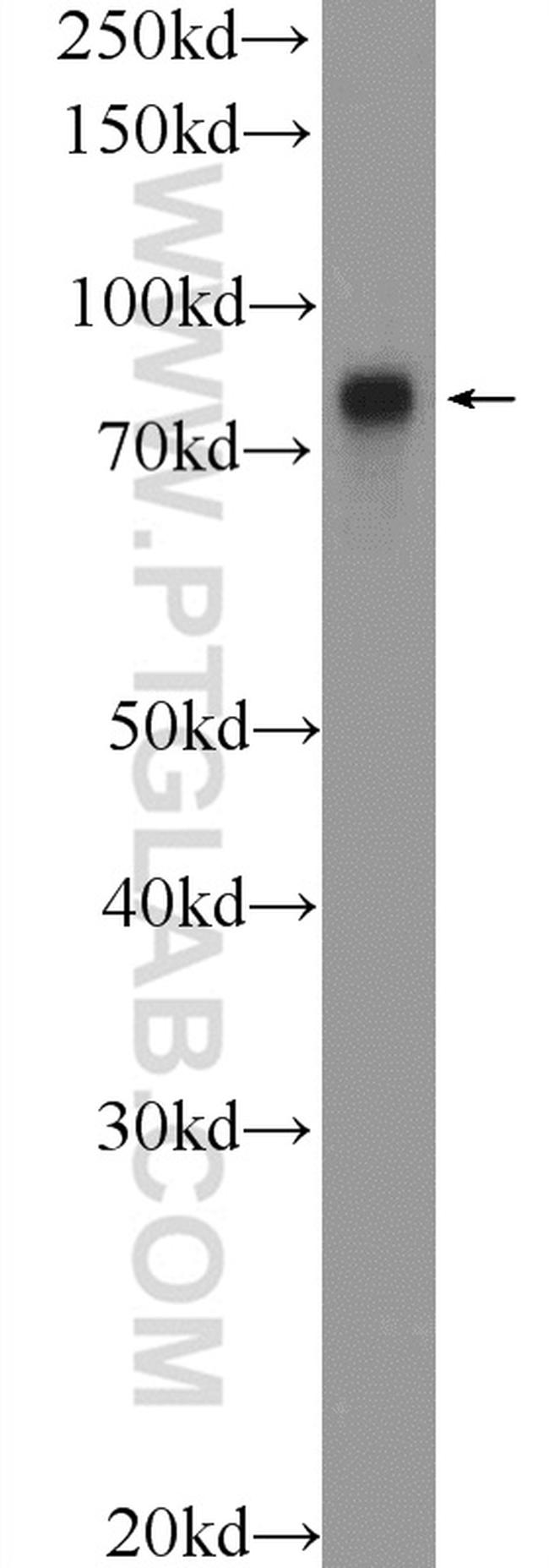 TARS2 Antibody in Western Blot (WB)