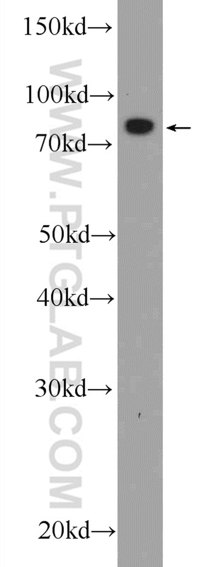 TARS2 Antibody in Western Blot (WB)