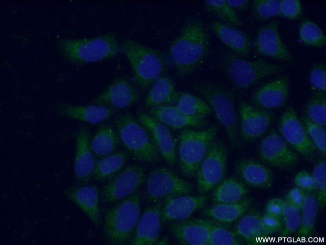 HPS1 Antibody in Immunocytochemistry (ICC/IF)