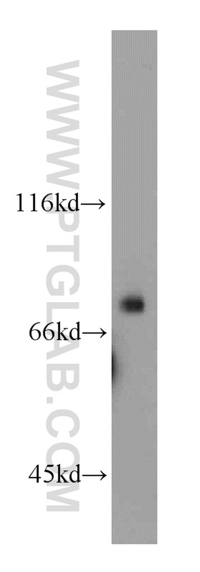 HPS1 Antibody in Western Blot (WB)