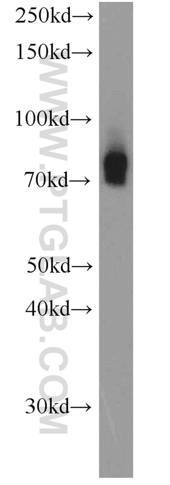 HPS1 Antibody in Western Blot (WB)