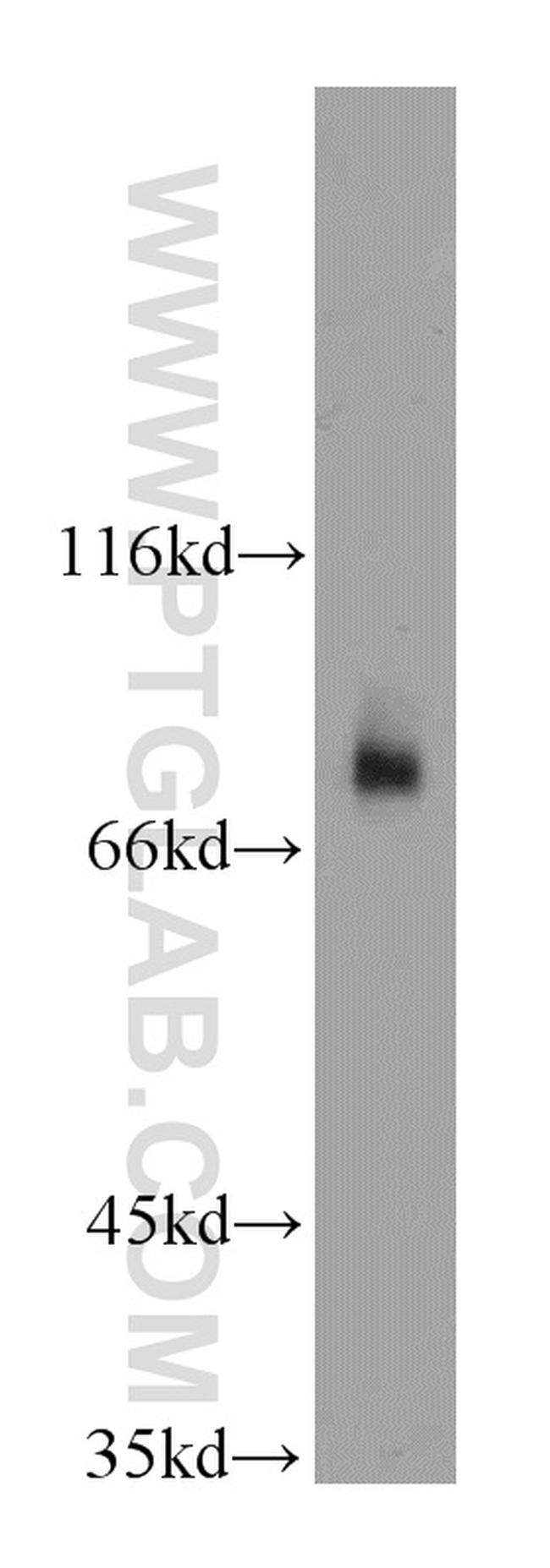 HPS1 Antibody in Western Blot (WB)