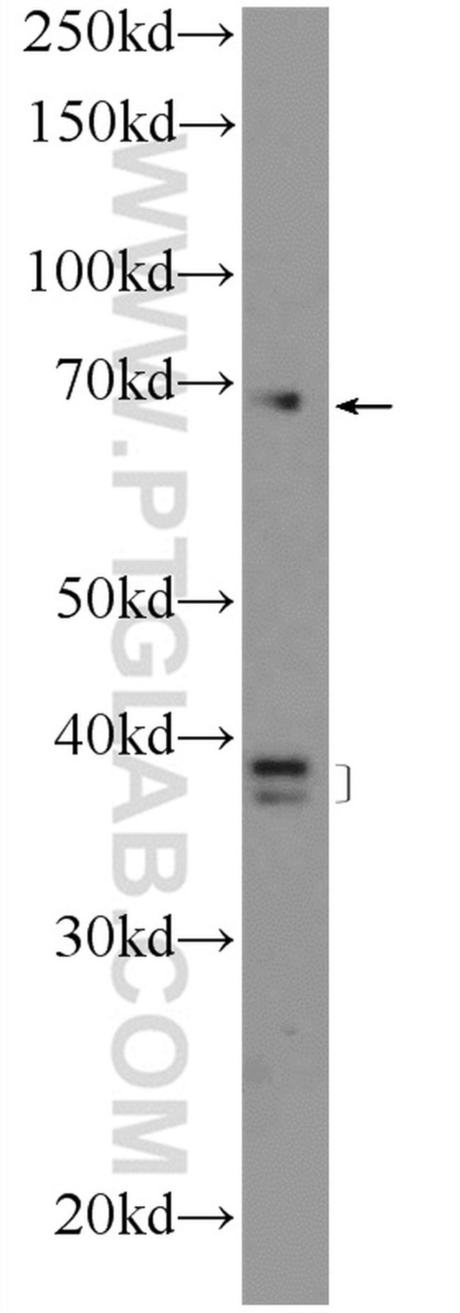 HPS1 Antibody in Western Blot (WB)