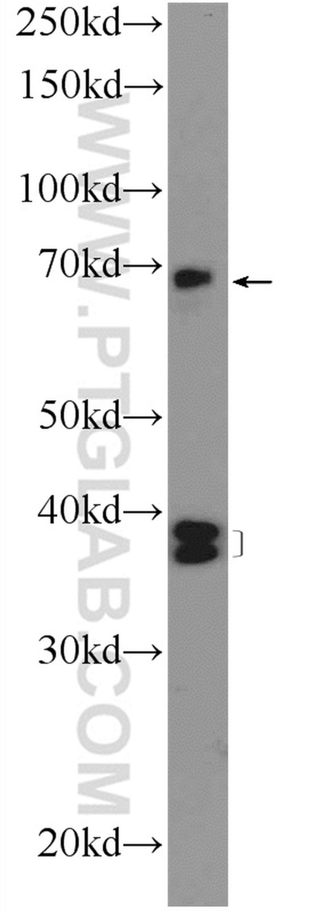 HPS1 Antibody in Western Blot (WB)