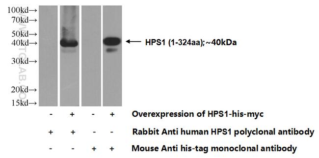 HPS1 Antibody in Western Blot (WB)