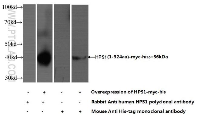 HPS1 Antibody in Western Blot (WB)