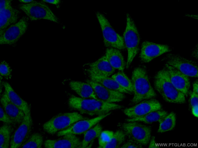 CAPRIN1 Antibody in Immunocytochemistry (ICC/IF)