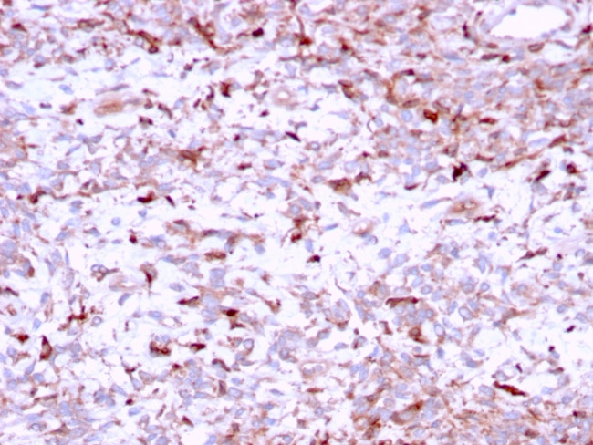 Cathepsin K Antibody in Immunohistochemistry (Paraffin) (IHC (P))