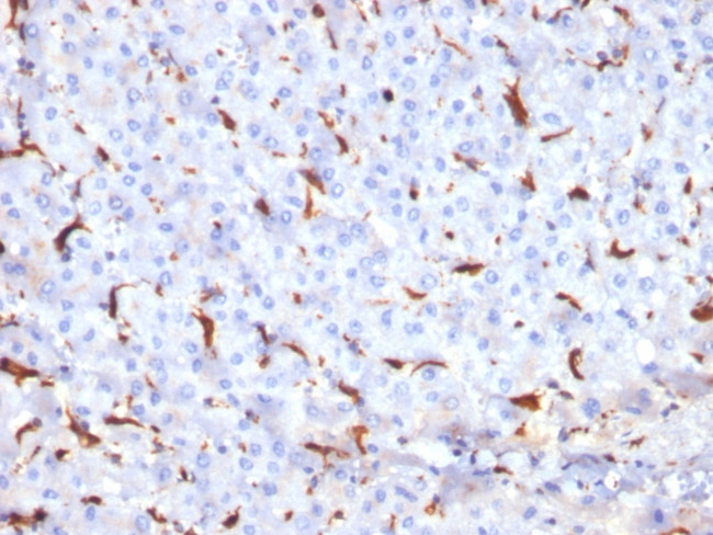 Cathepsin K Antibody in Immunohistochemistry (Paraffin) (IHC (P))