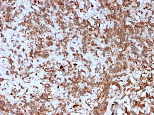 Cathepsin K Antibody in Immunohistochemistry (Paraffin) (IHC (P))