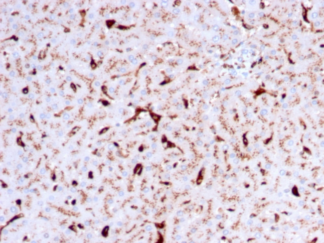 Cathepsin K Antibody in Immunohistochemistry (Paraffin) (IHC (P))