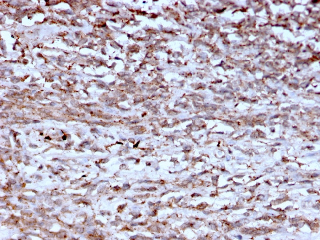 Cathepsin K Antibody in Immunohistochemistry (Paraffin) (IHC (P))