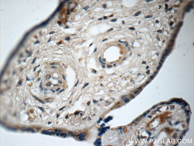 FUCA2 Antibody in Immunohistochemistry (Paraffin) (IHC (P))