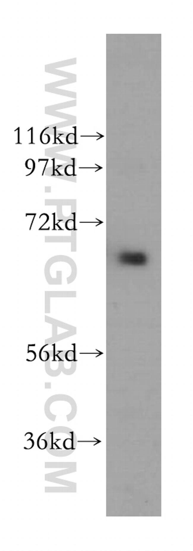 MEN1 Antibody in Western Blot (WB)