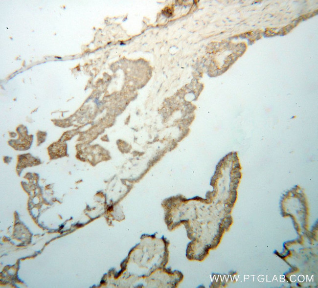 WDR18 Antibody in Immunohistochemistry (Paraffin) (IHC (P))