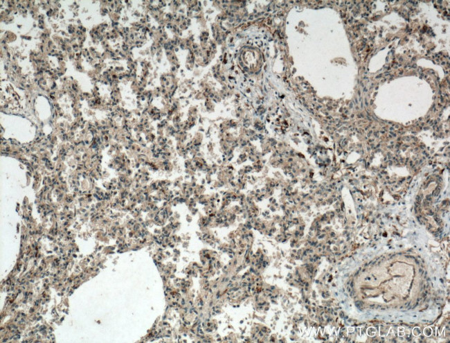 WDR18 Antibody in Immunohistochemistry (Paraffin) (IHC (P))