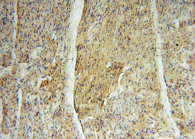 MRPS34 Antibody in Immunohistochemistry (Paraffin) (IHC (P))