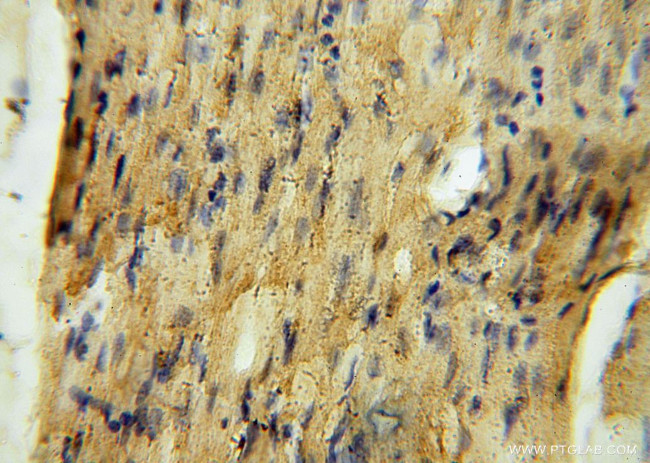 MRPS34 Antibody in Immunohistochemistry (Paraffin) (IHC (P))