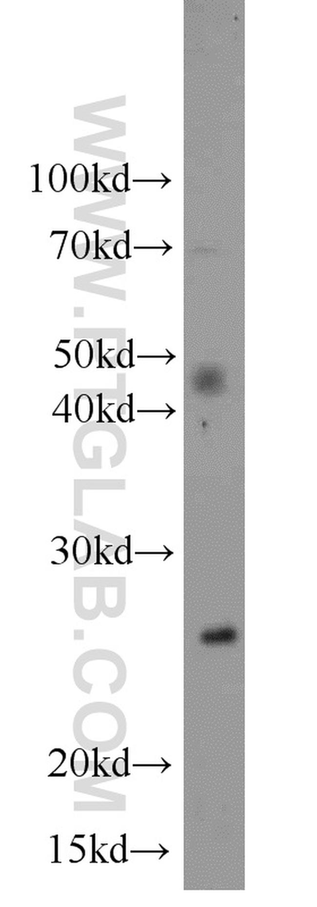 SIGMAR1 Antibody in Western Blot (WB)