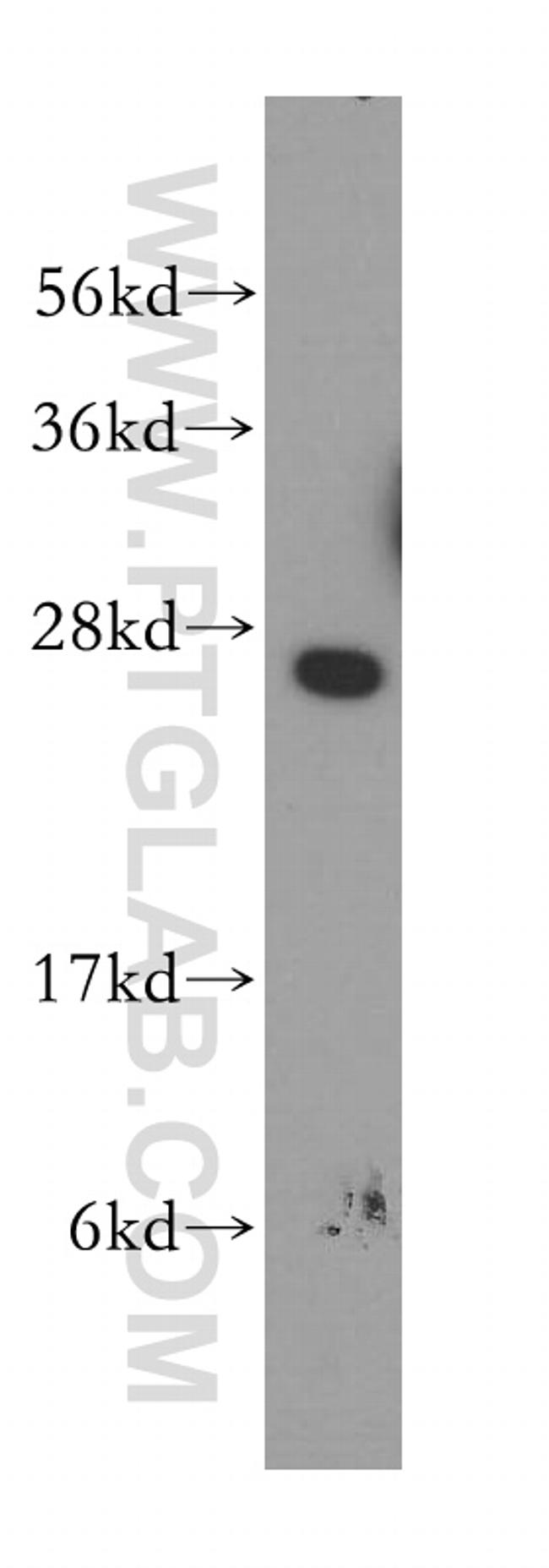 SIGMAR1 Antibody in Western Blot (WB)