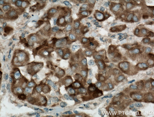SIGMAR1 Antibody in Immunohistochemistry (Paraffin) (IHC (P))