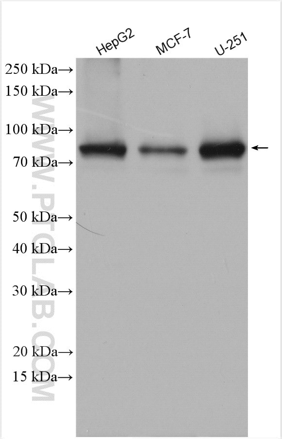 CPT1A Antibody in Western Blot (WB)