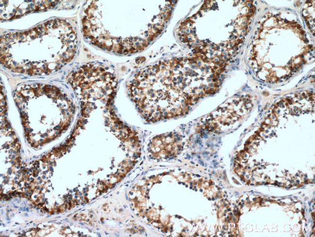 DCXR Antibody in Immunohistochemistry (Paraffin) (IHC (P))