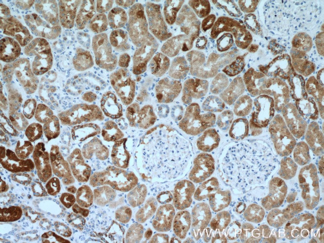 DCXR Antibody in Immunohistochemistry (Paraffin) (IHC (P))