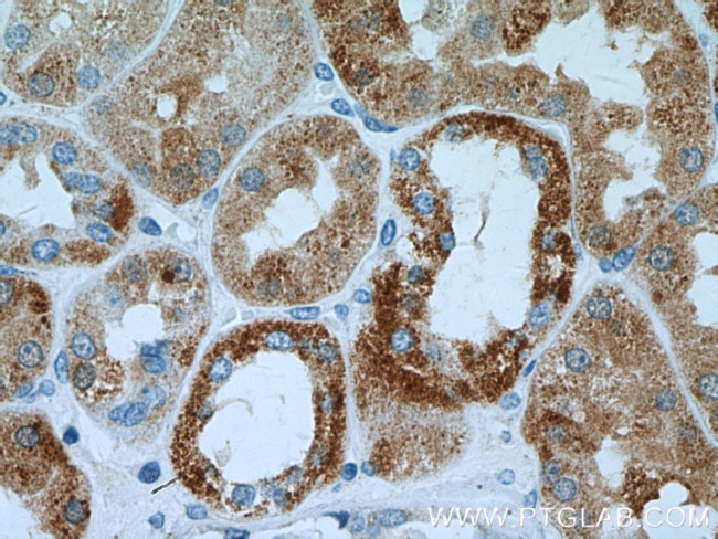 DCXR Antibody in Immunohistochemistry (Paraffin) (IHC (P))